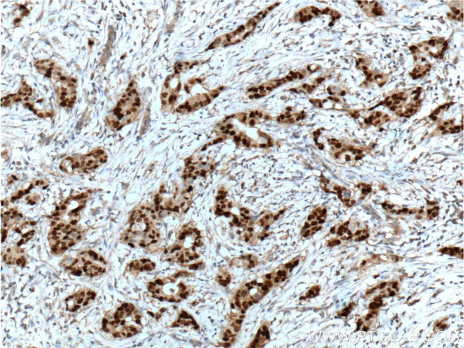 PR Antibody in Immunohistochemistry (Paraffin) (IHC (P))