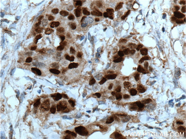 PR Antibody in Immunohistochemistry (Paraffin) (IHC (P))