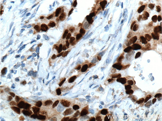 PR Antibody in Immunohistochemistry (Paraffin) (IHC (P))