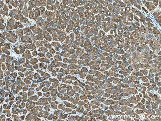 LAMP2 Antibody in Immunohistochemistry (Paraffin) (IHC (P))