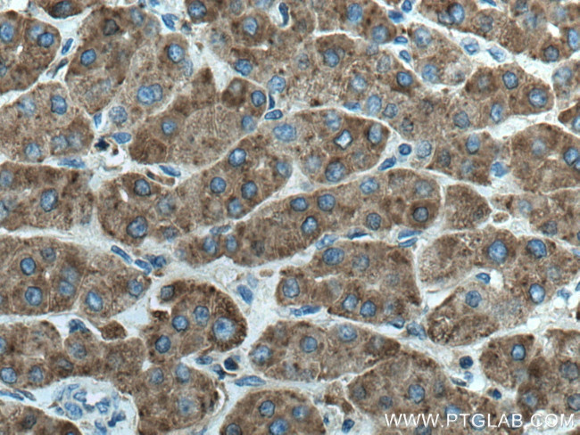 LAMP2 Antibody in Immunohistochemistry (Paraffin) (IHC (P))