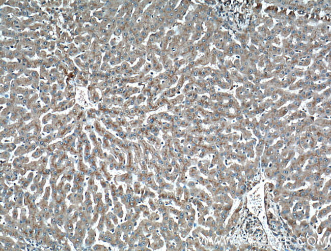 LAMP2 Antibody in Immunohistochemistry (Paraffin) (IHC (P))