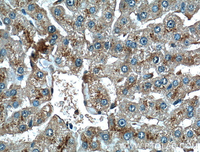 LAMP2 Antibody in Immunohistochemistry (Paraffin) (IHC (P))