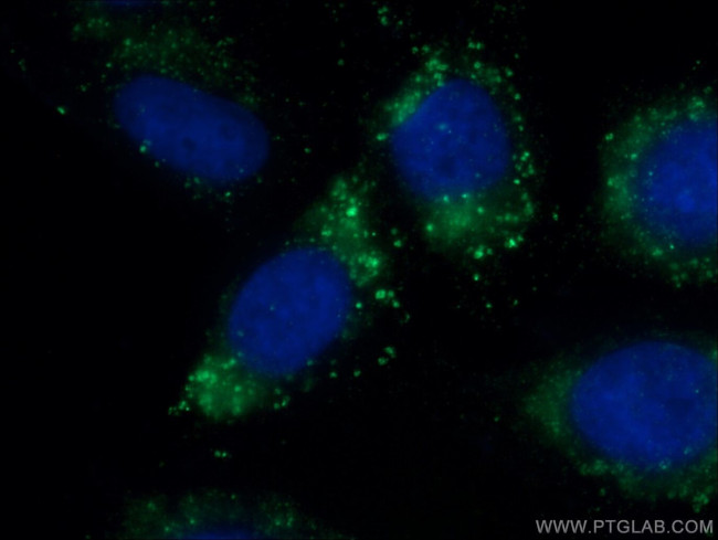 LAMP2 Antibody in Immunocytochemistry (ICC/IF)