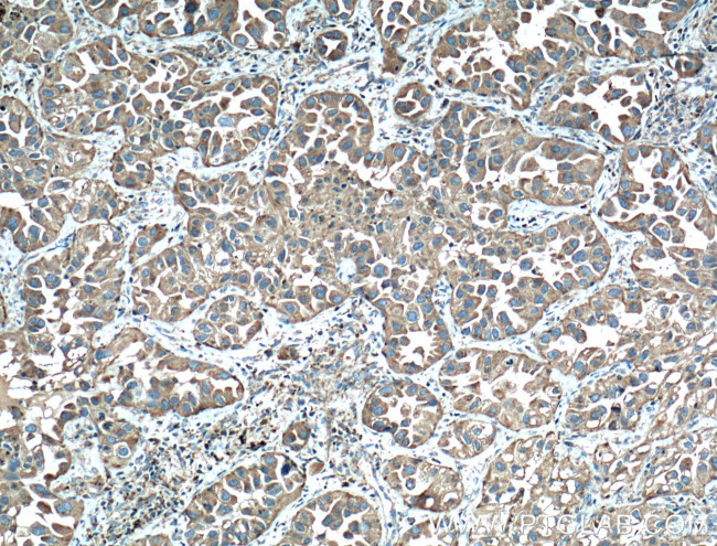 LAMP2 Antibody in Immunohistochemistry (Paraffin) (IHC (P))