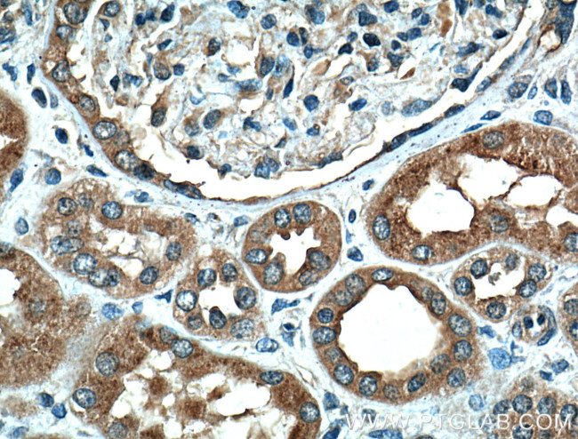 LAMP2 Antibody in Immunohistochemistry (Paraffin) (IHC (P))