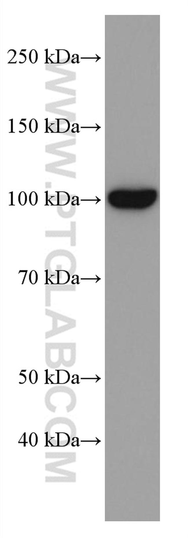 LAMP2 Antibody in Western Blot (WB)