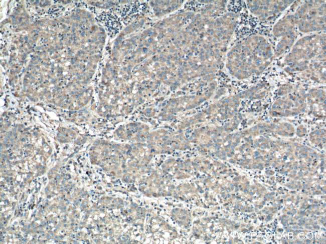 CHCHD2 Antibody in Immunohistochemistry (Paraffin) (IHC (P))