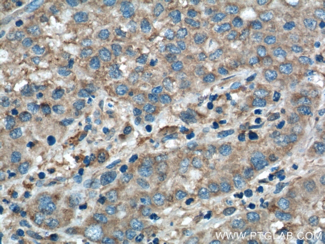 CHCHD2 Antibody in Immunohistochemistry (Paraffin) (IHC (P))