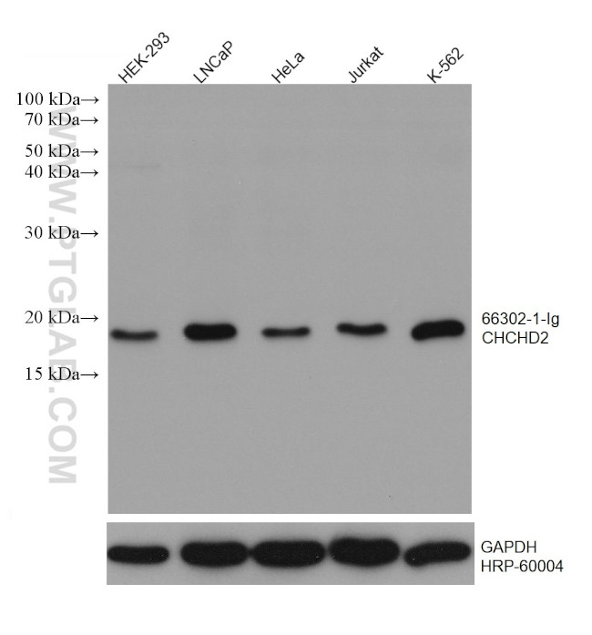 CHCHD2 Antibody in Western Blot (WB)