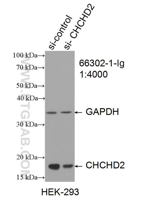 CHCHD2 Antibody in Western Blot (WB)