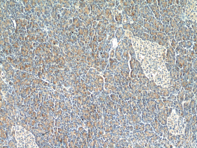 LIPH Antibody in Immunohistochemistry (Paraffin) (IHC (P))