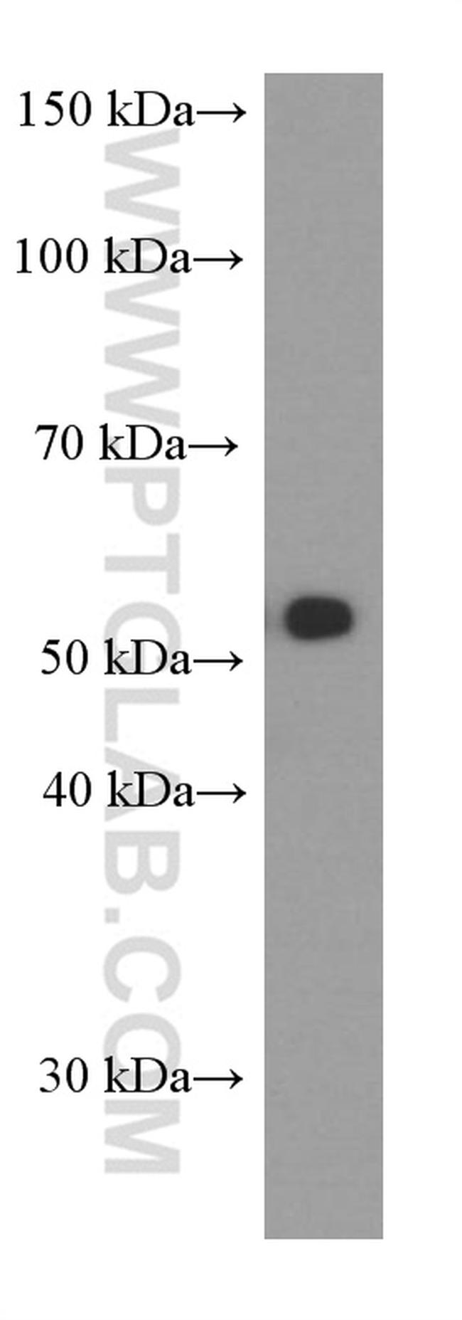 CD47 Antibody in Western Blot (WB)