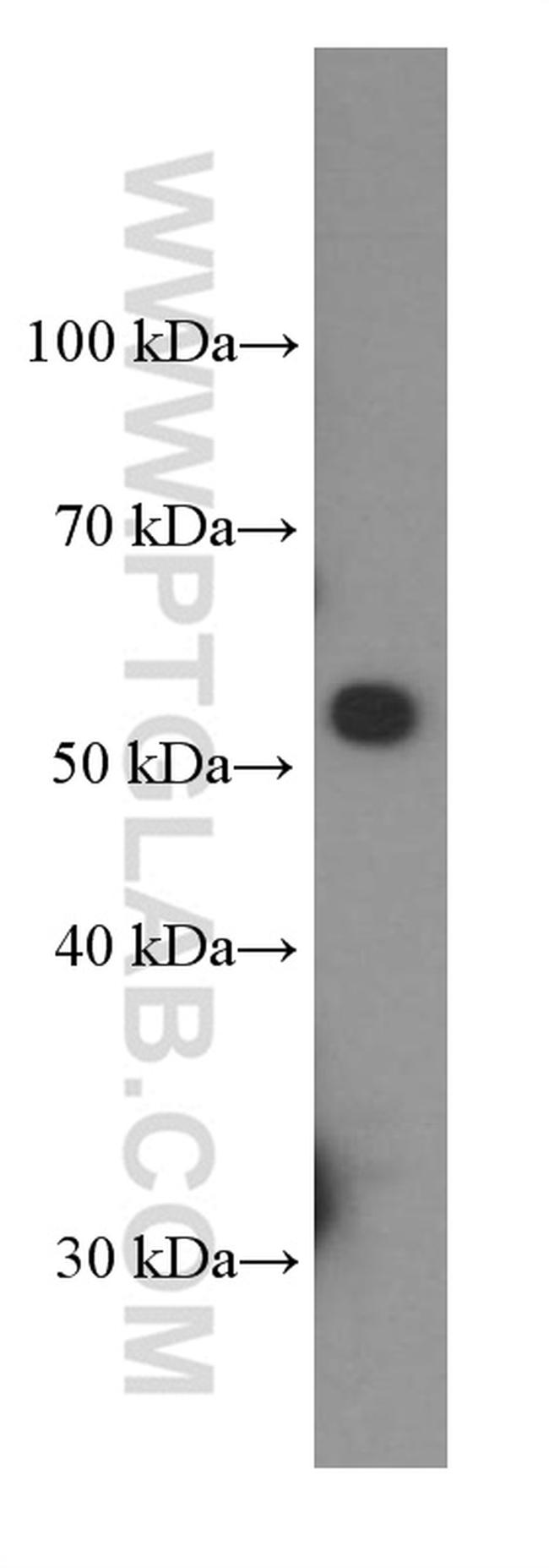 CD47 Antibody in Western Blot (WB)