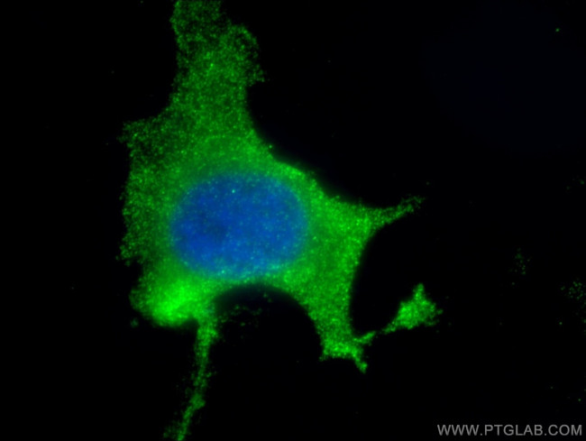 Vinculin Antibody in Immunocytochemistry (ICC/IF)