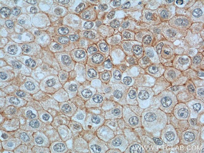 Vinculin Antibody in Immunohistochemistry (Paraffin) (IHC (P))