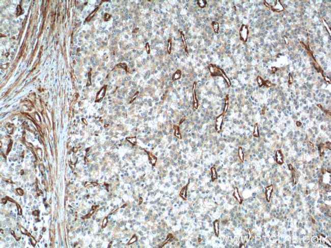 Vinculin Antibody in Immunohistochemistry (Paraffin) (IHC (P))