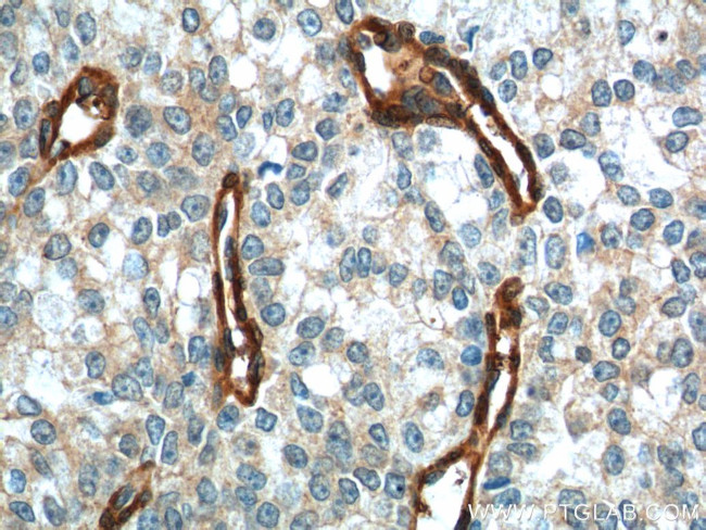 Vinculin Antibody in Immunohistochemistry (Paraffin) (IHC (P))