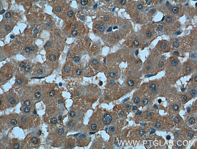 TBL2 Antibody in Immunohistochemistry (Paraffin) (IHC (P))