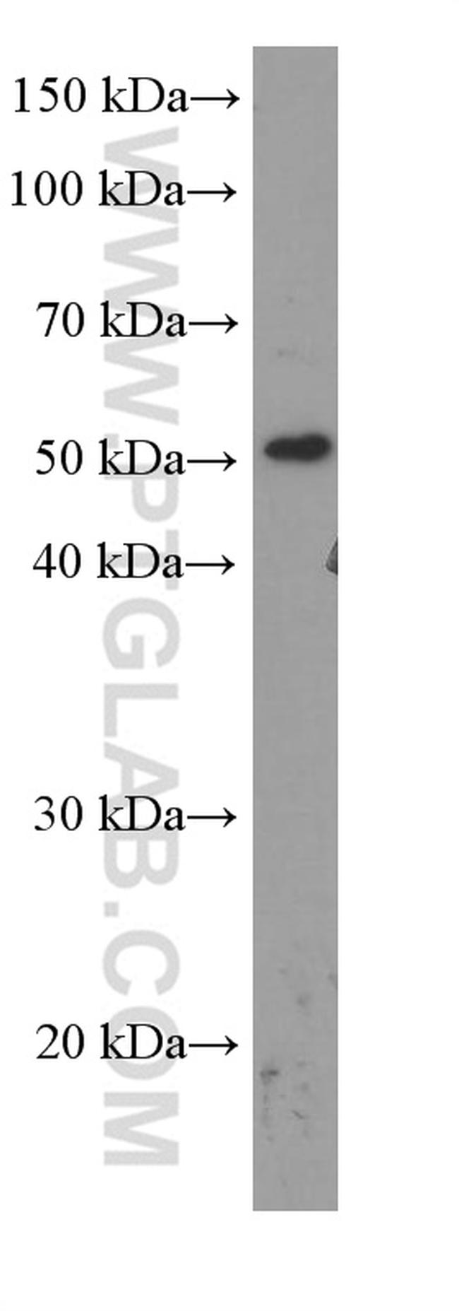 TBL2 Antibody in Western Blot (WB)