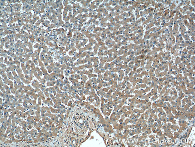 TBL2 Antibody in Immunohistochemistry (Paraffin) (IHC (P))