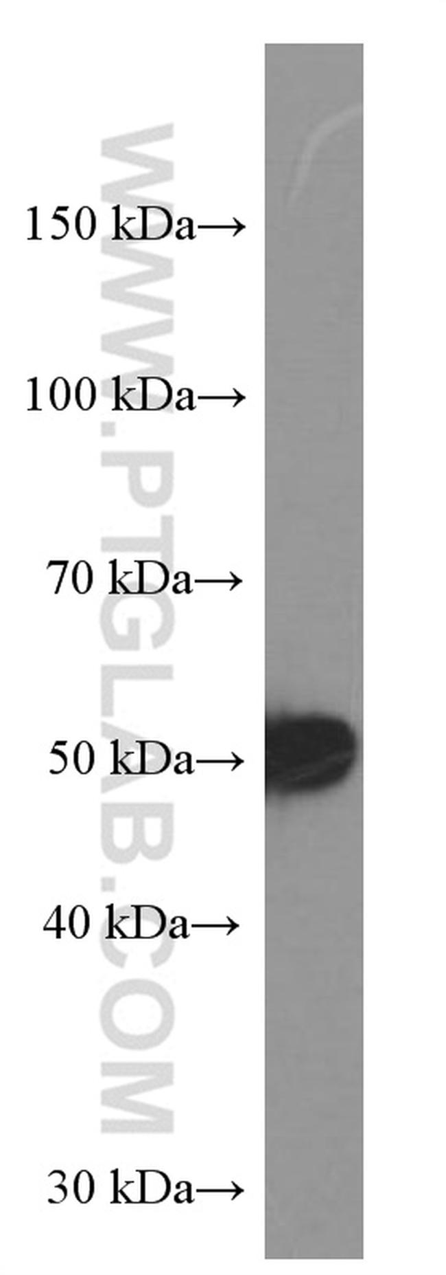 TBL2 Antibody in Western Blot (WB)