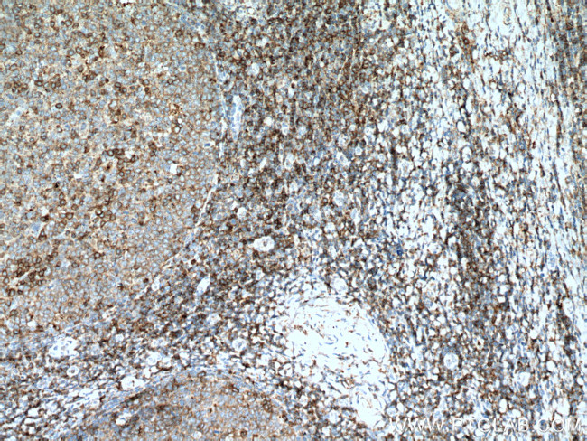 CD27 Antibody in Immunohistochemistry (Paraffin) (IHC (P))