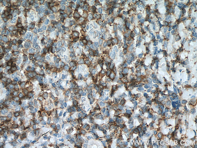 CD27 Antibody in Immunohistochemistry (Paraffin) (IHC (P))