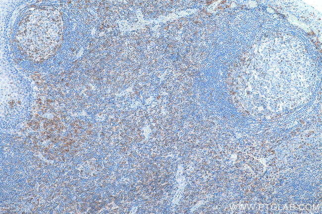 CD27 Antibody in Immunohistochemistry (Paraffin) (IHC (P))