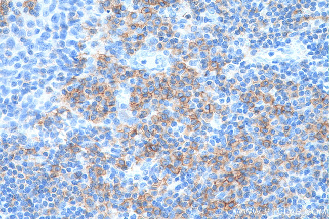 CD27 Antibody in Immunohistochemistry (Paraffin) (IHC (P))