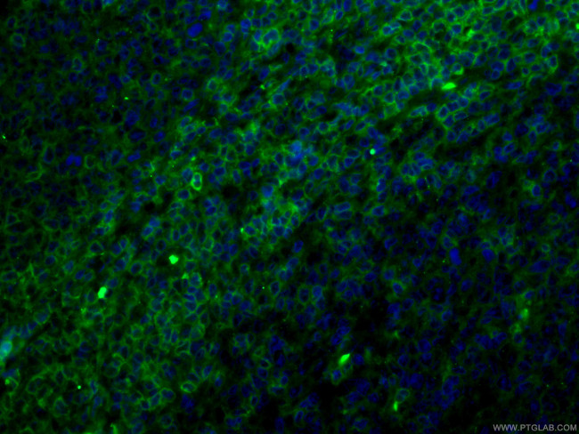 CD27 Antibody in Immunohistochemistry (PFA fixed) (IHC (PFA))