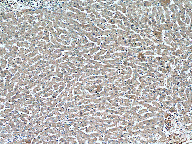 PEX5 Antibody in Immunohistochemistry (Paraffin) (IHC (P))