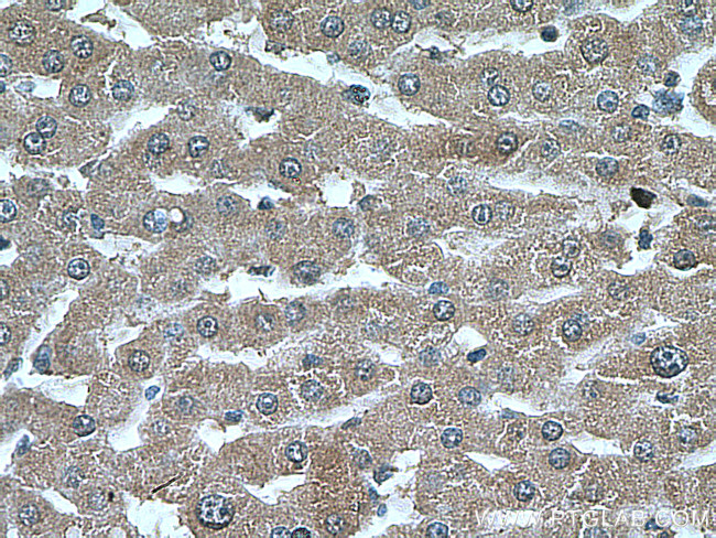 PEX5 Antibody in Immunohistochemistry (Paraffin) (IHC (P))