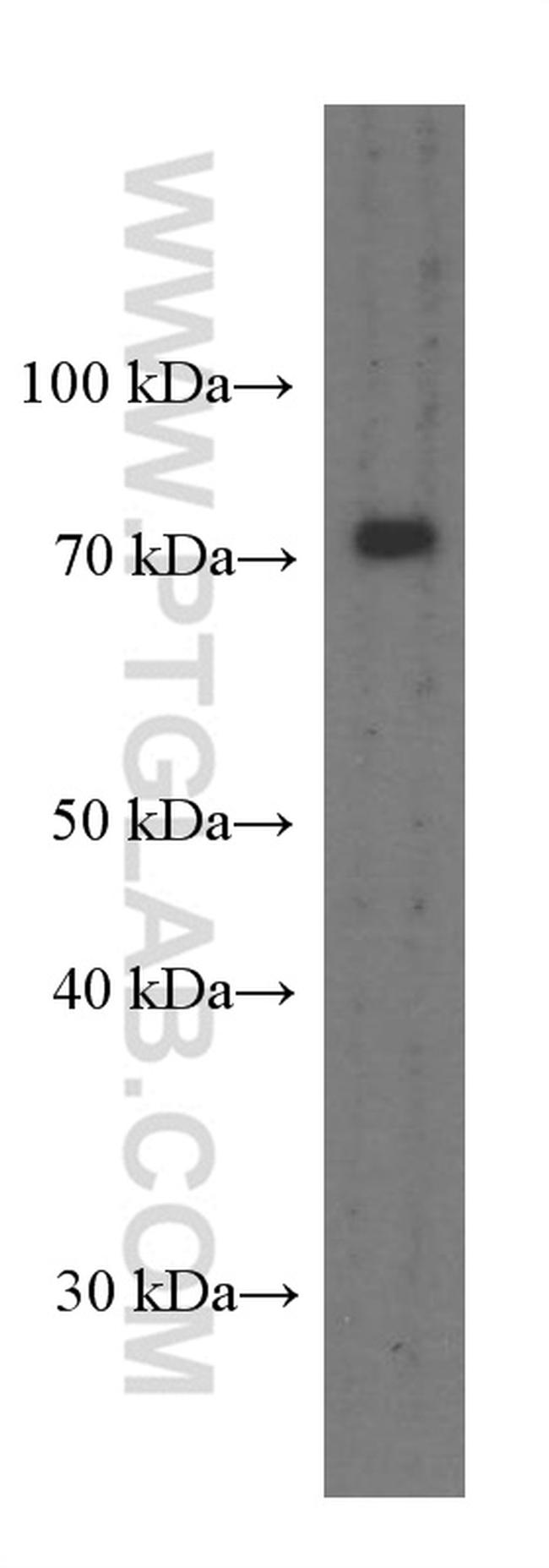 PEX5 Antibody in Western Blot (WB)