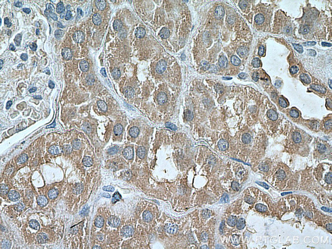 PEX5 Antibody in Immunohistochemistry (Paraffin) (IHC (P))