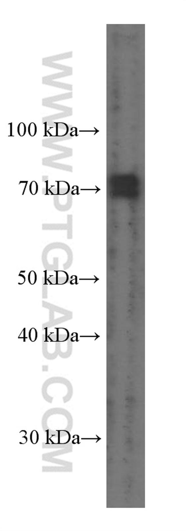 PEX5 Antibody in Western Blot (WB)