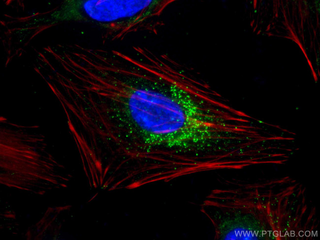 TRAF3 Antibody in Immunocytochemistry (ICC/IF)