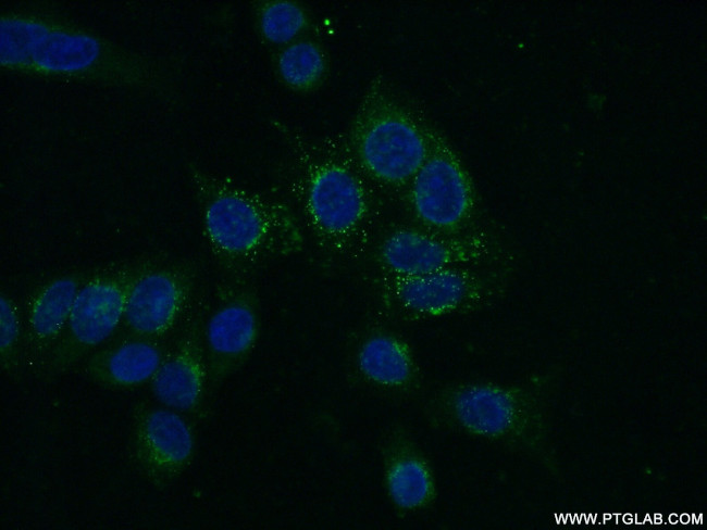 TRAF3 Antibody in Immunocytochemistry (ICC/IF)