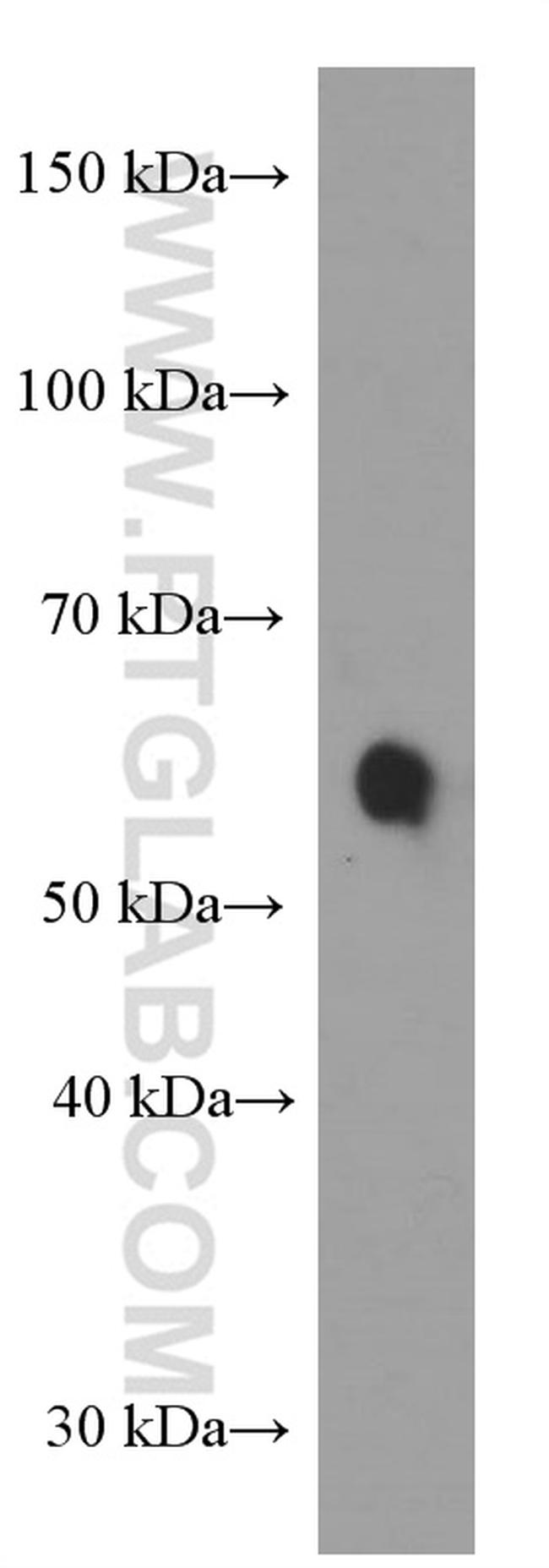 TRAF3 Antibody in Western Blot (WB)