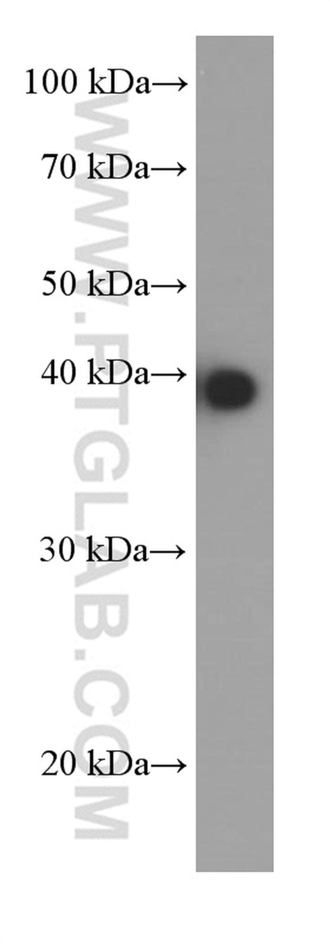 JUN Antibody in Western Blot (WB)