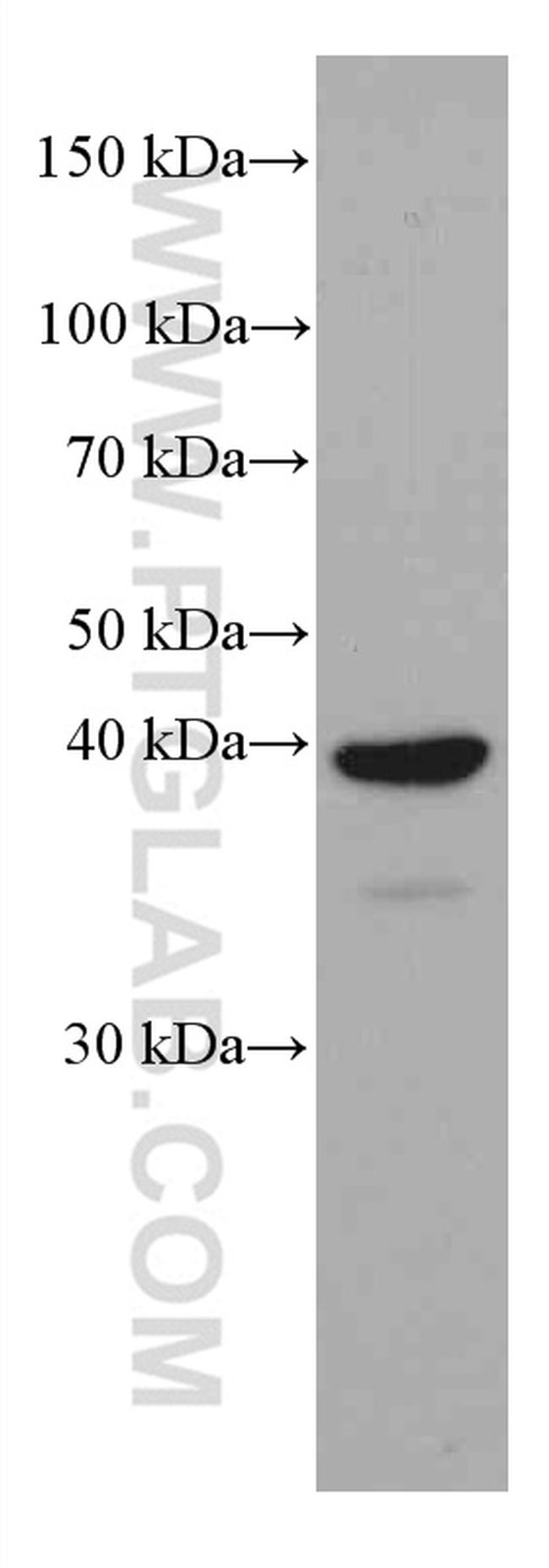 JUN Antibody in Western Blot (WB)