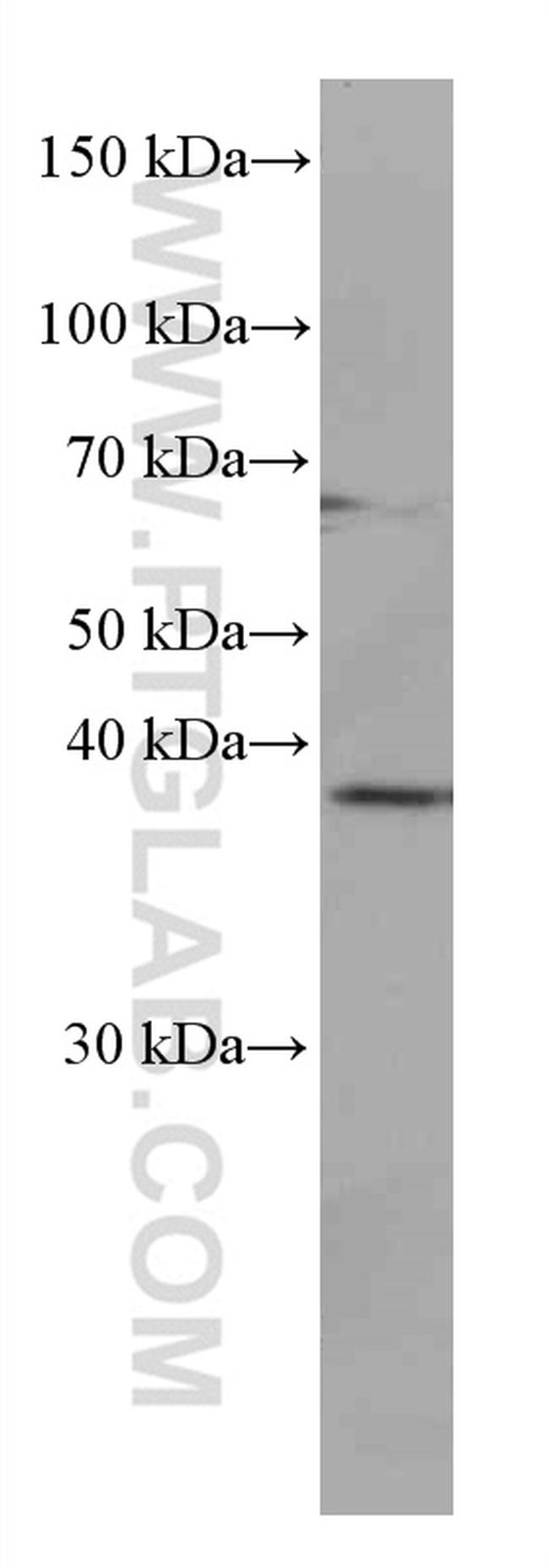 JUN Antibody in Western Blot (WB)