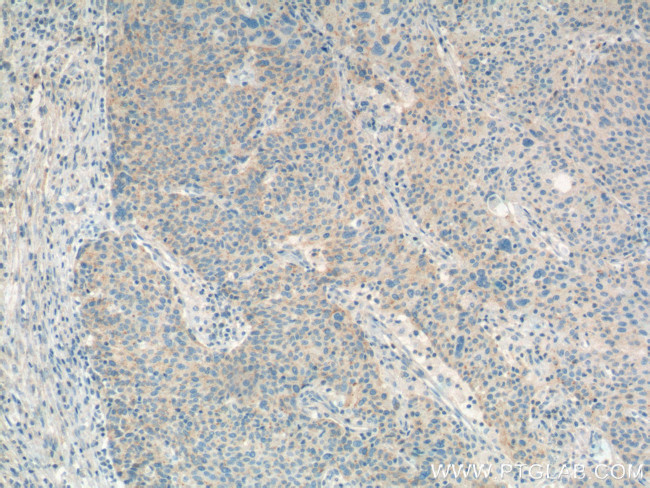 RSPO3 Antibody in Immunohistochemistry (Paraffin) (IHC (P))