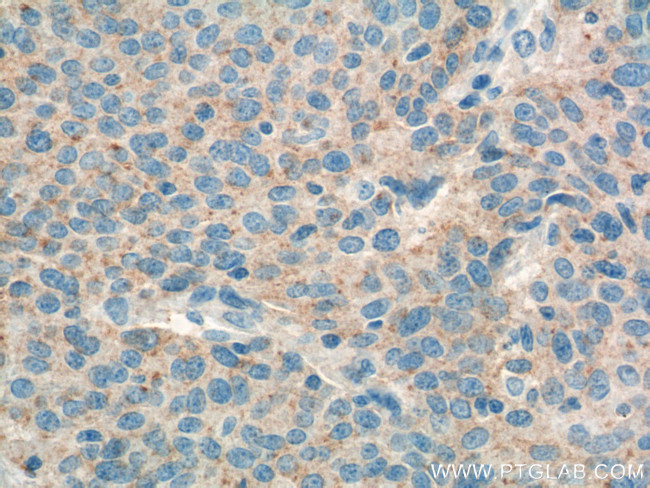 RSPO3 Antibody in Immunohistochemistry (Paraffin) (IHC (P))