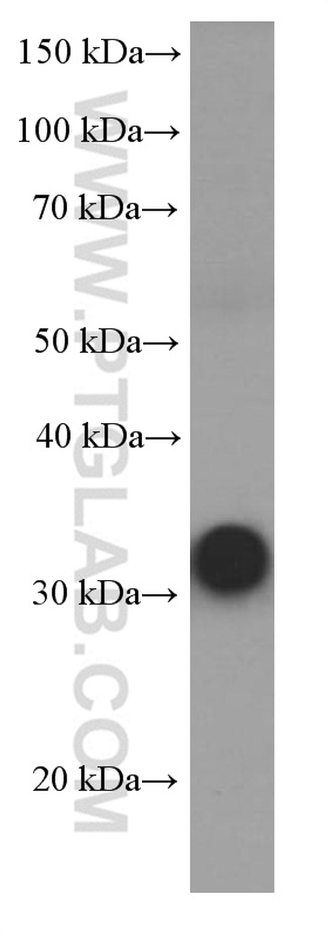 RSPO3 Antibody in Western Blot (WB)