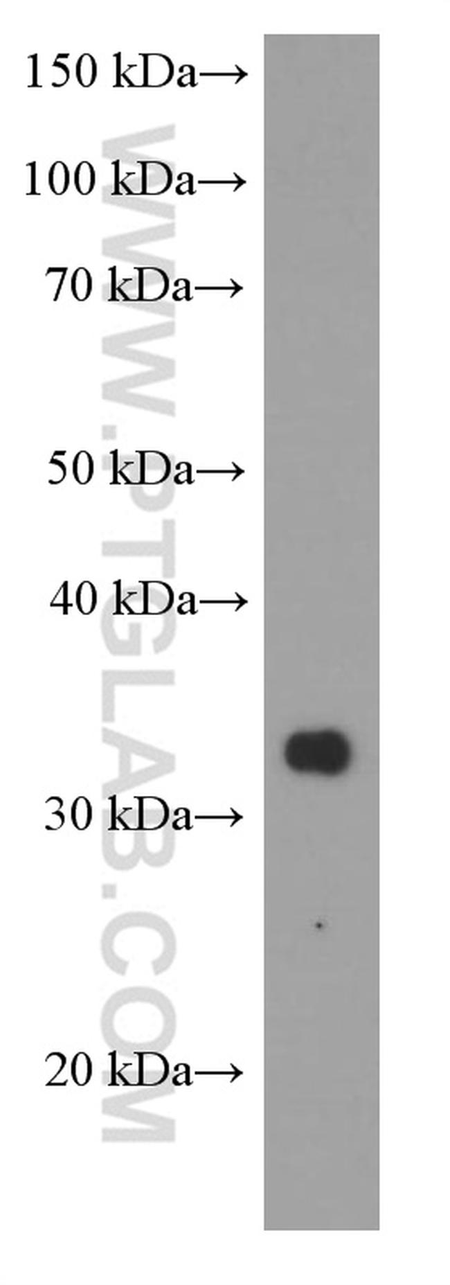 RSPO3 Antibody in Western Blot (WB)