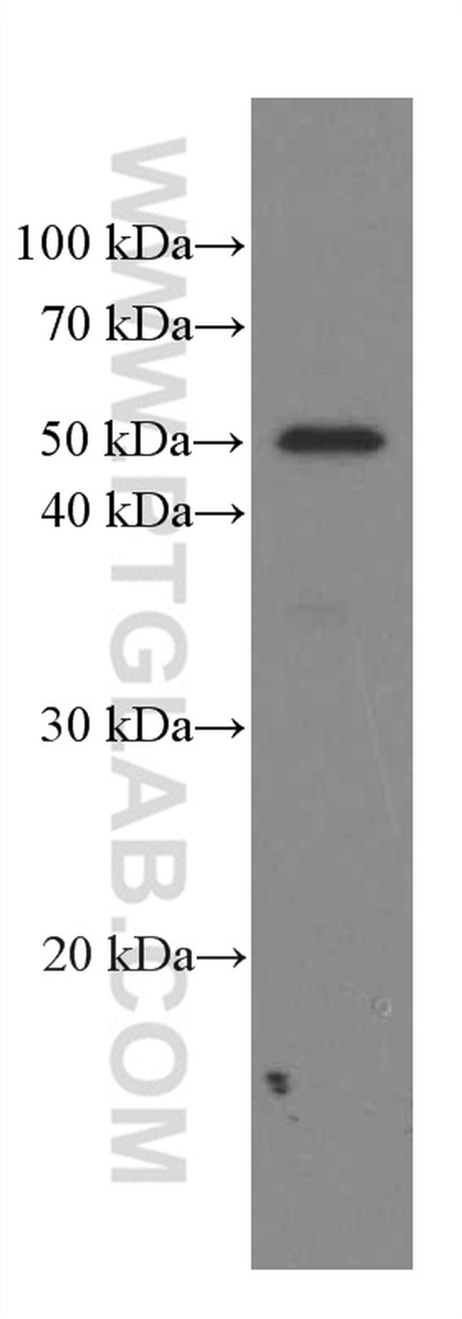 Phospho-TDP43 (Ser409, Ser410) Antibody in Western Blot (WB)