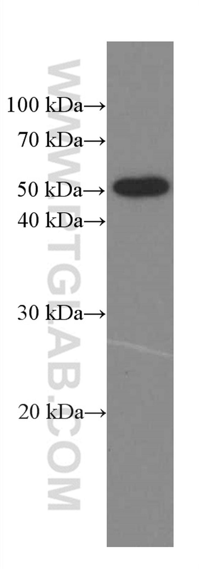 Phospho-TDP43 (Ser409, Ser410) Antibody in Western Blot (WB)