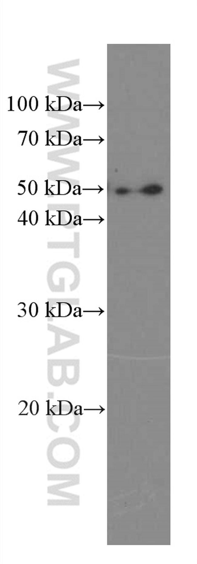 Phospho-TDP43 (Ser409, Ser410) Antibody in Western Blot (WB)
