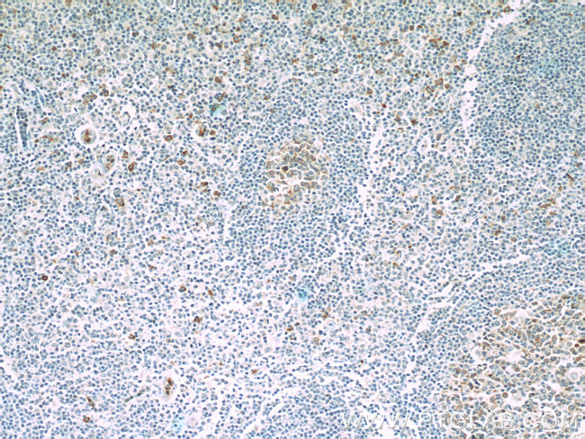 IL21R Antibody in Immunohistochemistry (Paraffin) (IHC (P))